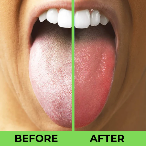 ORAL CARE - Nano Toothbrush & Tongue Cleaner Bundle