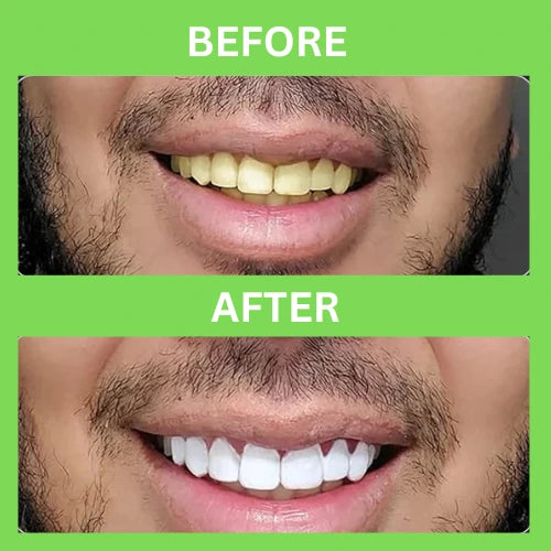 Oral Care - Activated Charcoal Whitening Powder